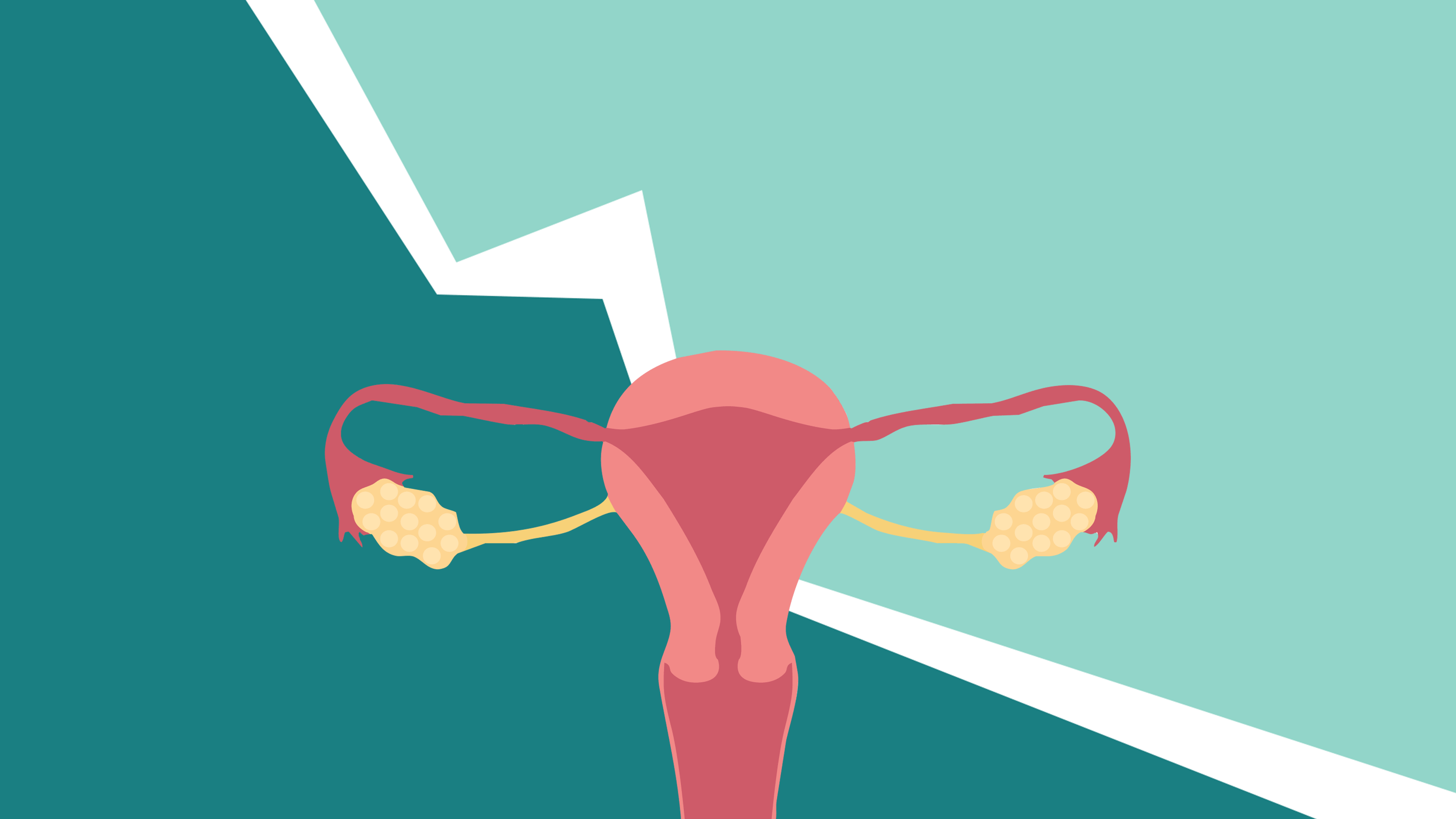 A endometriose afeta de 10 a 15% das mulheres em idade reprodutiva